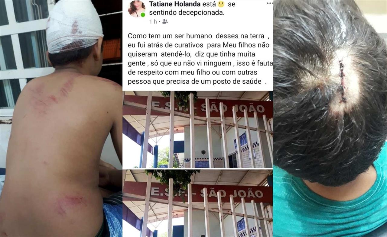 “Não quiseram atendê-lo” diz mãe de criança que ficou sem curativo