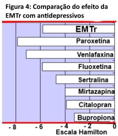 Estimulação Magnética Transcraniana (EMTr) em Depressão