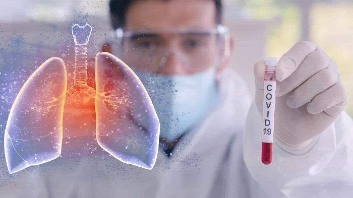 Cientistas criam teste para Covid-19 com resultados em 30 minutos