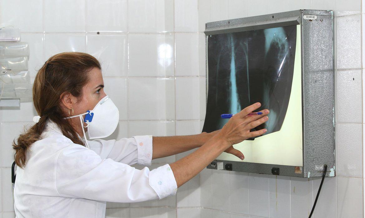 Brasil registra 200 casos de tuberculose por dia