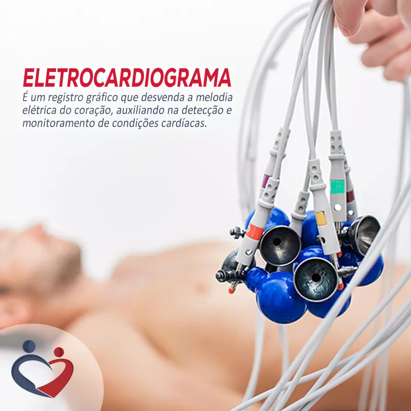 Eletrocardiograma