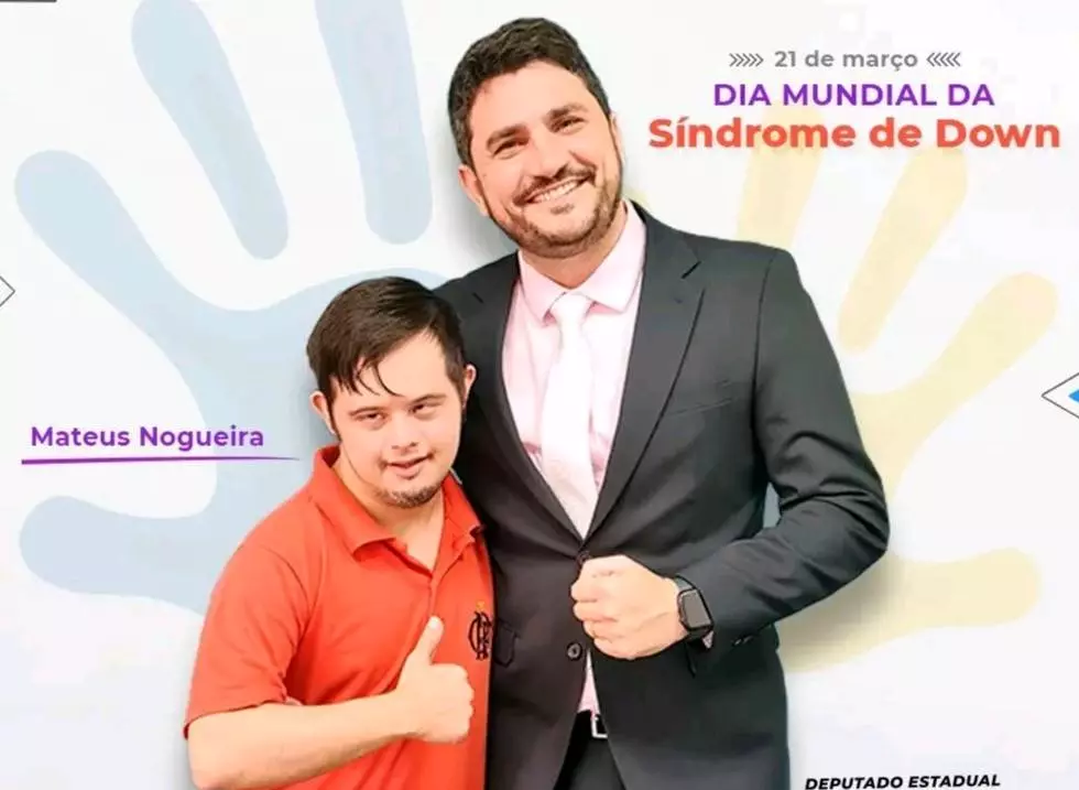 No Dia Mundial da Síndrome de Down Deputado Jean Mendonça conclama população para conscientização