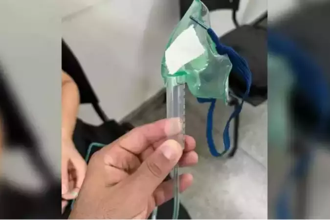 Enfermeira e médico salvam vida de bebê com máscara de oxigênio improvisada