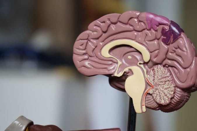 Novo medicamento para Alzheimer retarda estágio inicial da doença